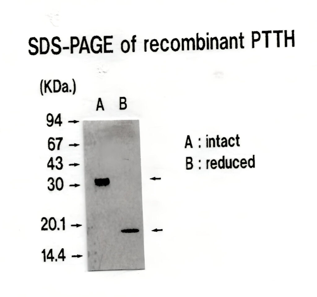 図3 大腸菌PTTHのSDS電気泳動
